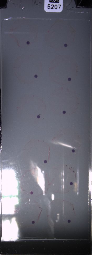 Media type: image; Special Collections 4011   shows specimen_part histological serial section;